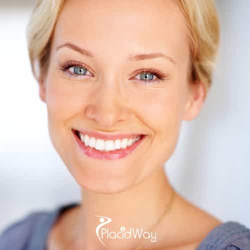 Why 2026 Trends in Alexandria Favor Ultra-Thin & No-Prep Porcelain Artistry?